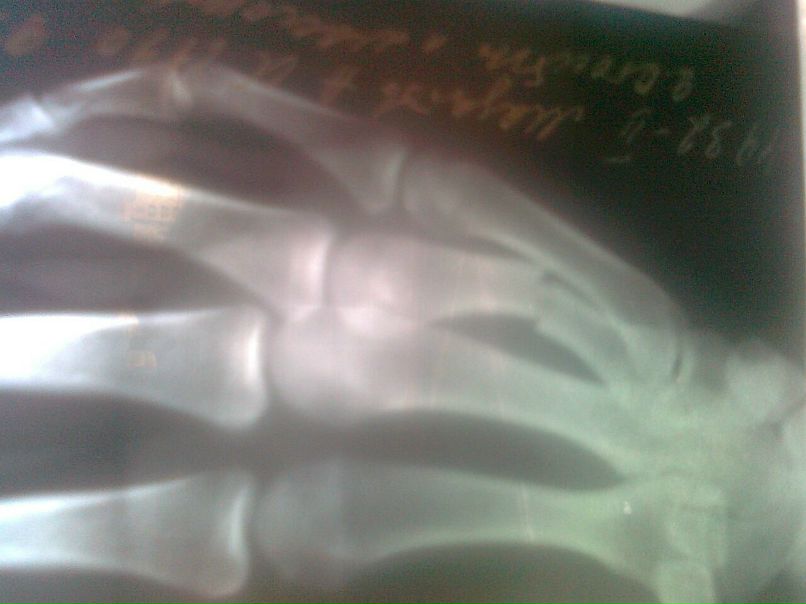 Арнольд Мадатов фотография #40